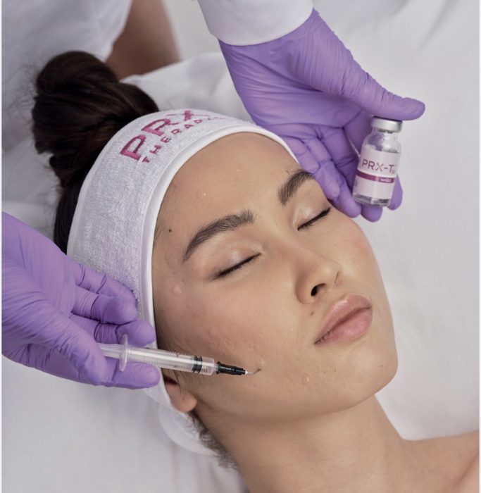 peeling PRX-T33 Wattrelos WiQo soin qualité de peau par une infirmière peeling PRX-T33 Wattrelos soin peau éclat infirmière