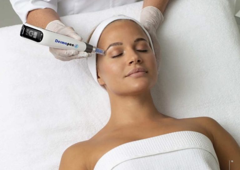 Séance microneedling avec le DermaPen 4 sur Wattrelos, proche de Roubaix. 